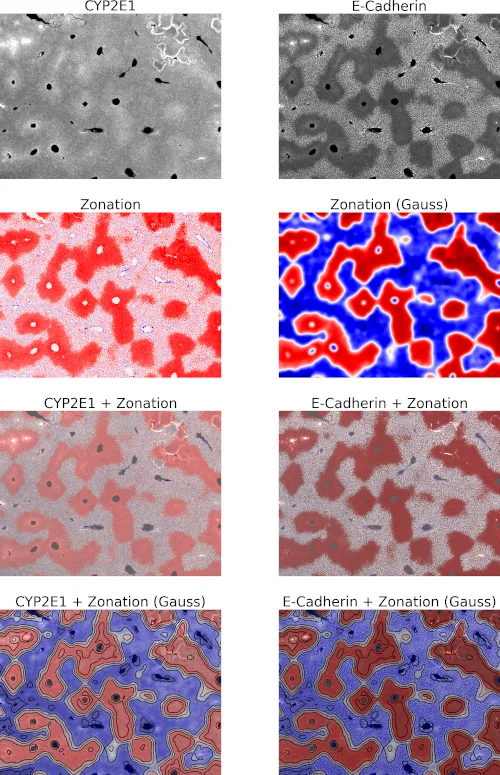 Hepatic zonation patterns of Cytochrome P450 enzymes