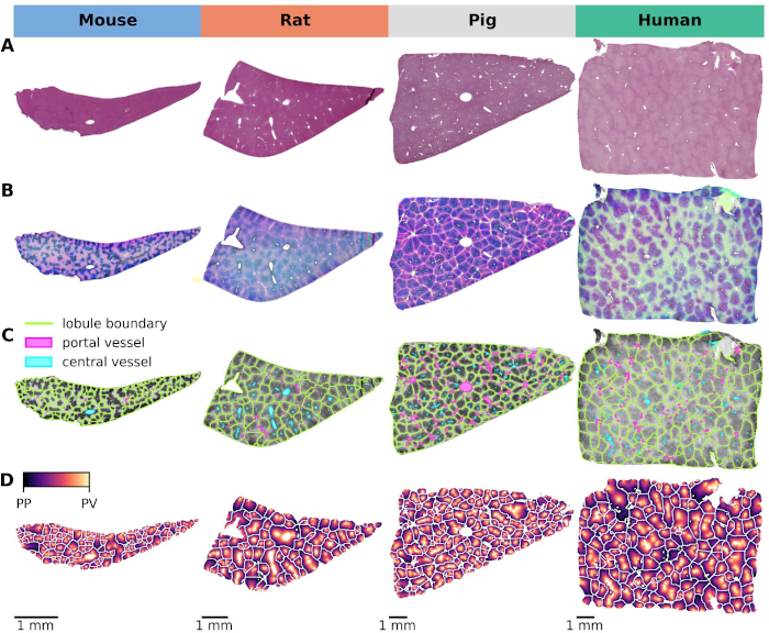 Analysis of hepatic zonation patterns from whole-slide images